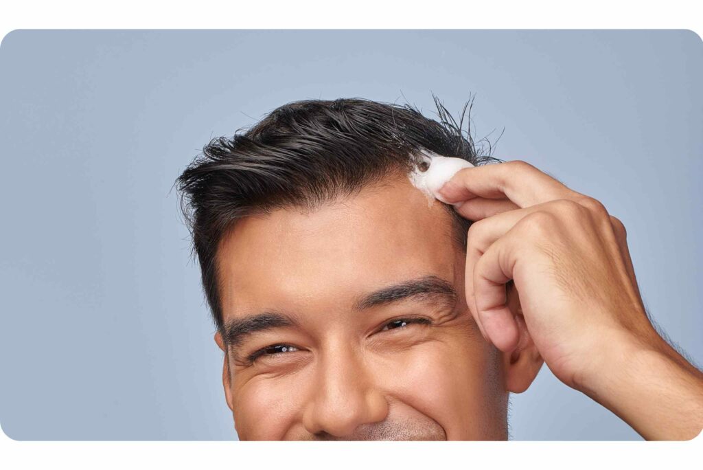 O que é minoxidil?