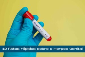 Herpes genital