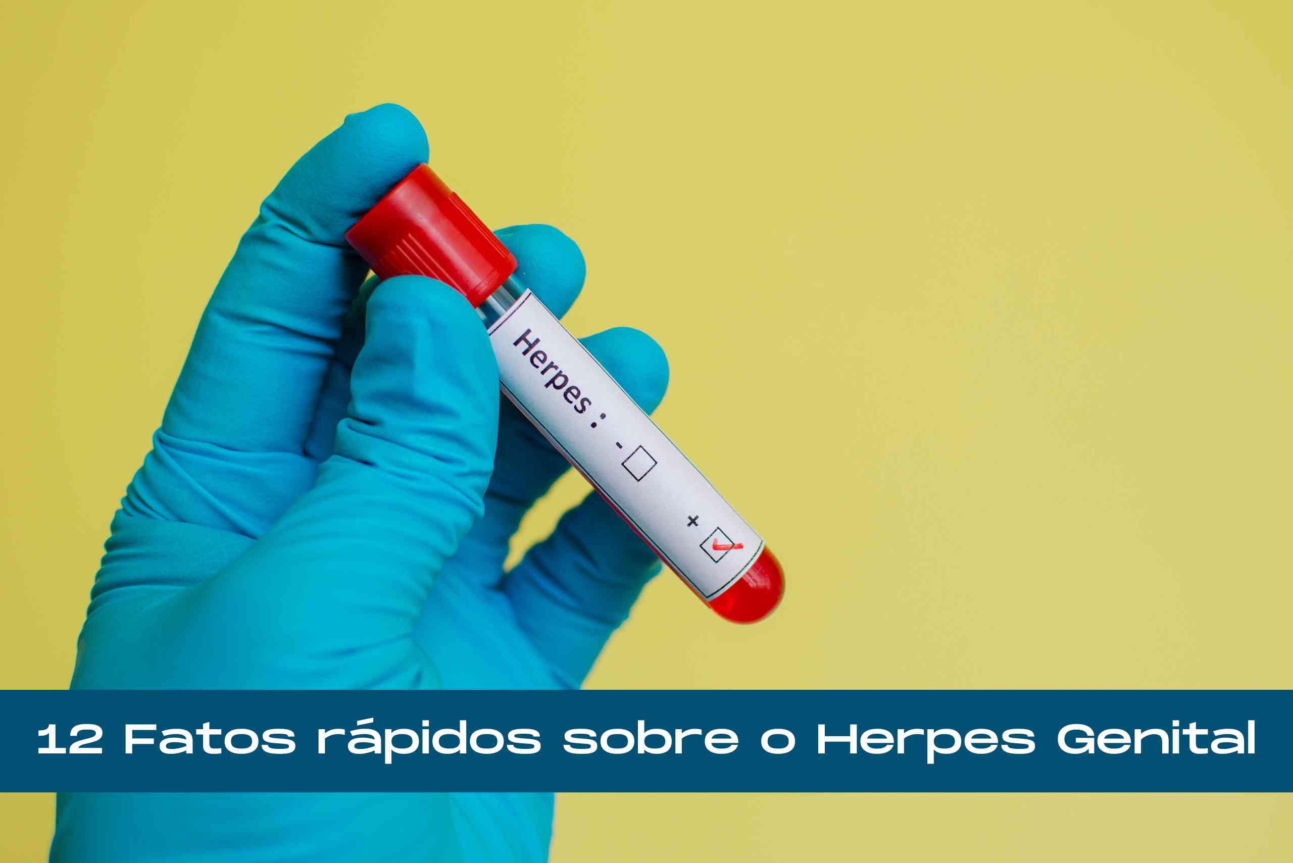 12 Fatos rápidos sobre o Herpes Genital Blog The Men's